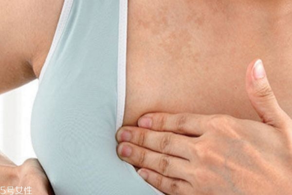 哺乳期乳房刺痛怎么回事 哺乳期乳房针扎的疼