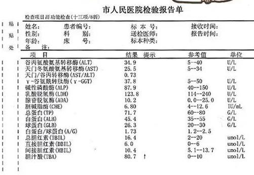 肝功能检查结果分析：教你看懂肝功能检查结果报告