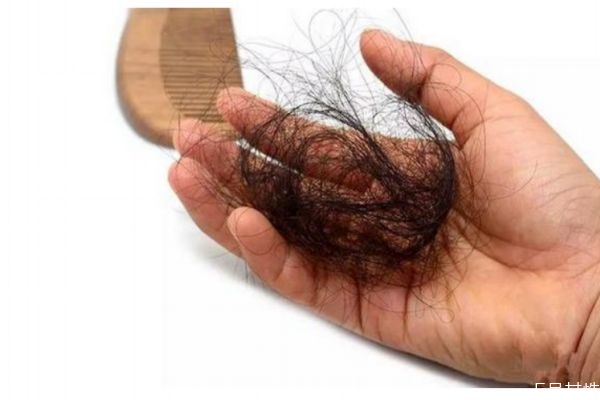 脱发造成的原因有什么呢 会什么会脱发呢