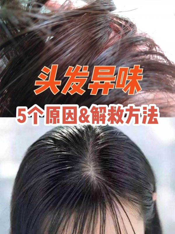 头发味道重是怎么肥事❓科学解救方法来了