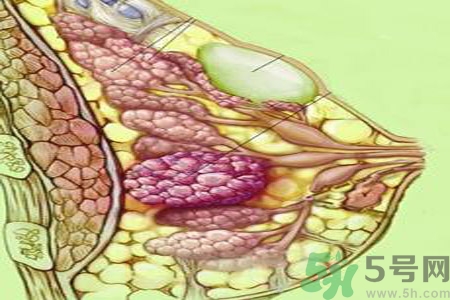 乳房屋硬块有疼痛感怎么回事？乳房屋硬块有疼痛感怎么办？