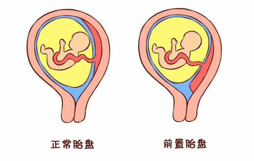 
	不同孕期的见红各代表什么
