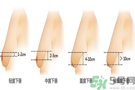 胸部松弛的原因是什么？胸部松弛该怎么办？