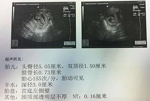 
	怀孕想知道男女最简单的方法(自测5个民间土方法)
