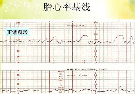 
	男女胎心率对照表 月份不同男女胎心率不一样
