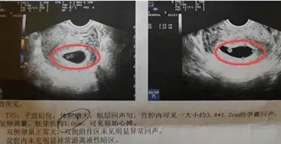 
	怀孕想知道男女最简单的方法(自测5个民间土方法)
