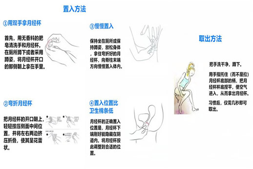 
	月经杯怎么用的 图解
