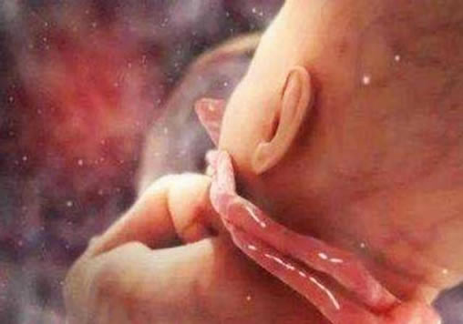 
	胎儿十男九绕颈是真的吗 是否属于正常？
