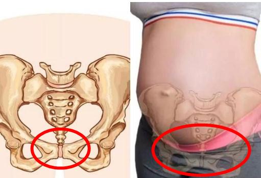 
	孕妇耻骨疼是哪个部位图解 耻骨疼是什么原因
