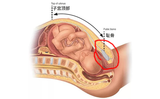 
	孕妇耻骨疼是哪个部位图解 耻骨疼是什么原因
