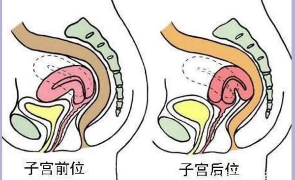 
	子宫前位和子宫后位图片区别 哪个比较容易受孕
