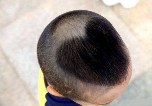 男宝宝桃心头5种新剪法 比光头时髦比寸头有创意的男幼童流行短发