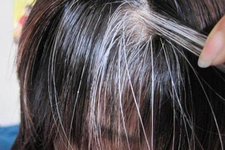 头发白了原因和如何避免增加数量？3种方法防止白头发