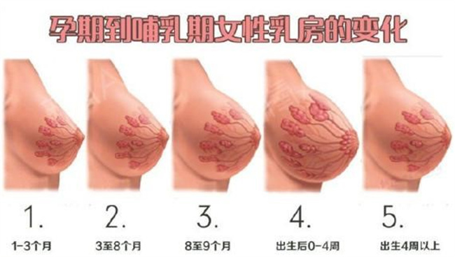 孕期乳房的这些变化，都正常吗？ 