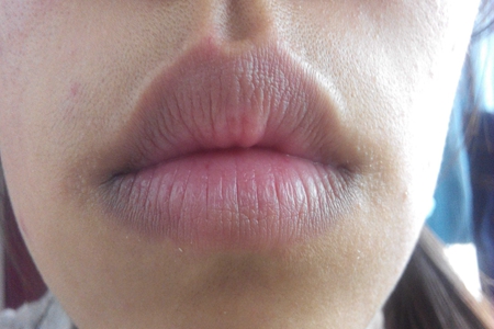 深究诱发唇部发黑原因，科学健康养生恢复光泽