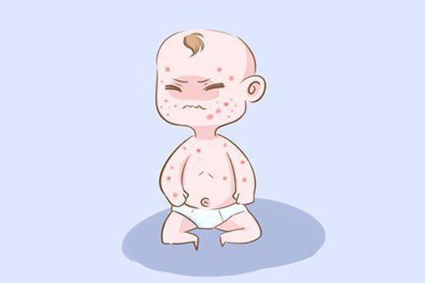 新生儿过敏可以洗澡吗 新生儿过敏可以用艾叶水洗澡吗