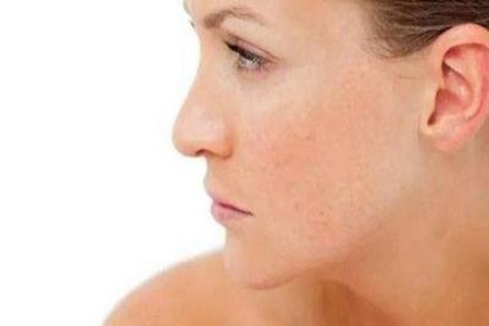 皮肤炎症的危害有哪些？敏感肌如何做好抗炎护肤