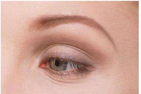 眼部肌肤的常见问题有哪些？不同年龄段如何选择眼霜