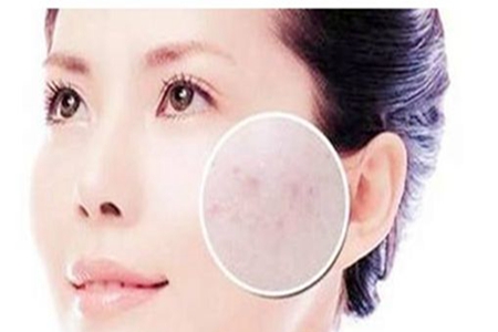 皮肤“外油内干”是什么原因造成的？如何缓解肌肤状况