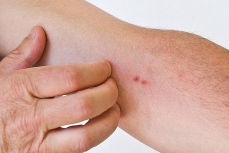 身体痒是什么原因，这3部位出现痒很有可能是疾病的信号