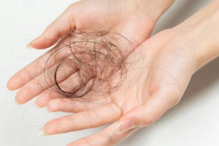 女性脱发是什么原因造成的？这四个诱因引发及时改善