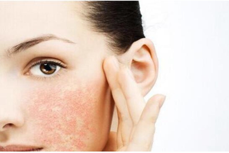 秋季皮肤抗过敏的方法，四个小妙招教你做好肌肤保养