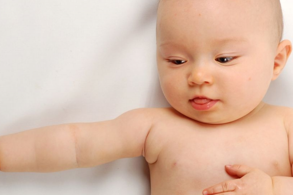 2个月婴儿感冒流鼻涕怎么办 这样解决 2个月宝宝感冒流鼻涕怎么办