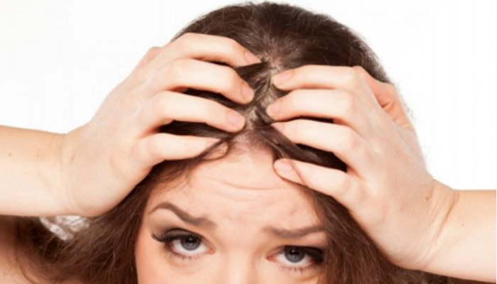 侧柏生发的使用方法  侧柏生发的用法 